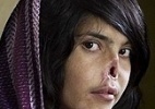 World Press Photo/Montagem BOL