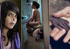 World Press Photo/Montagem BOL