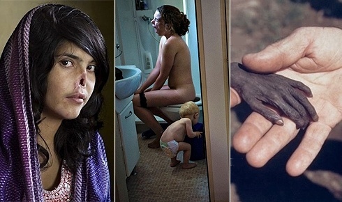 World Press Photo/Montagem BOL