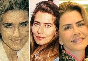 Montagem BOL